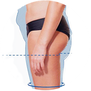 EMS testformáló kezelés utáni fenék állapot eredménye