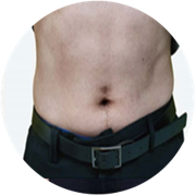 EMS testformáló kezelés utáni hasi állapot eredménye 3