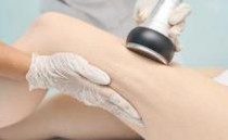 360 fokos krioliolízis CryoCool testformáló készülék zsírfagyasztó kavitációs kezelőfej folyamatban