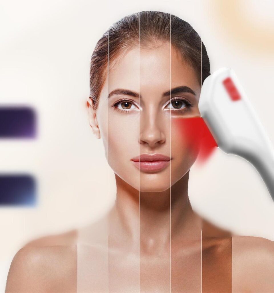 DPL plus szőrtelenítő, ér- és pigmentkezelő készülék kezeléskor