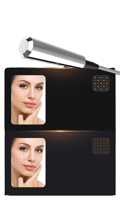 Pinxel mikrotűs RF rádiófrekvenciás kezelőgép monopólus, bipólus módban